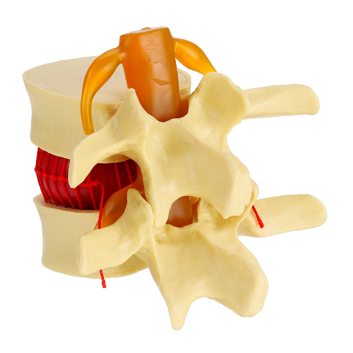 anatomisch menselijk skelet wervelkolom lumbale wervels degeneratieve schijf model