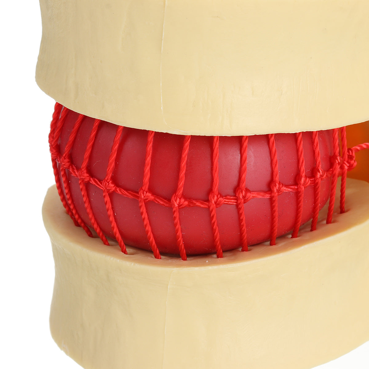 anatomisch menselijk skelet wervelkolom lumbale wervels degeneratieve schijf model