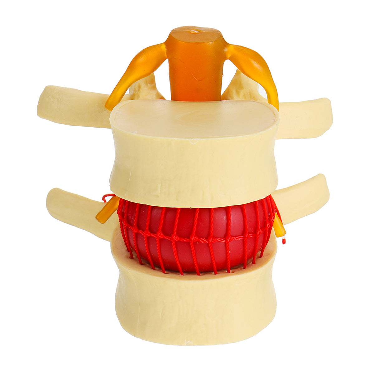 anatomisch menselijk skelet wervelkolom lumbale wervels degeneratieve schijf model