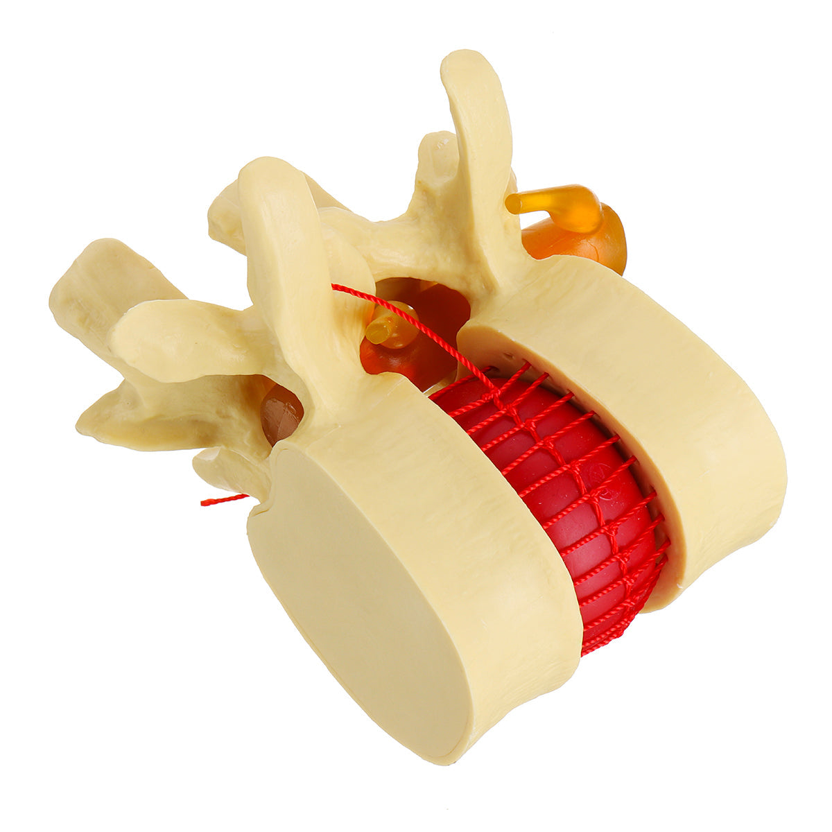 anatomisch menselijk skelet wervelkolom lumbale wervels degeneratieve schijf model