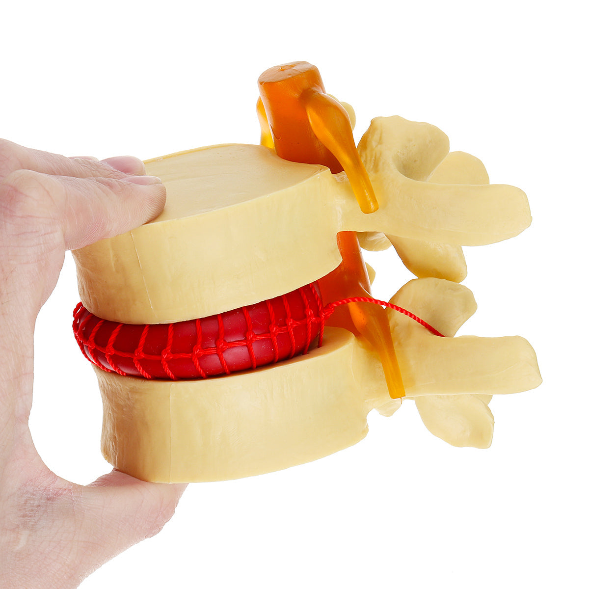 anatomisch menselijk skelet wervelkolom lumbale wervels degeneratieve schijf model