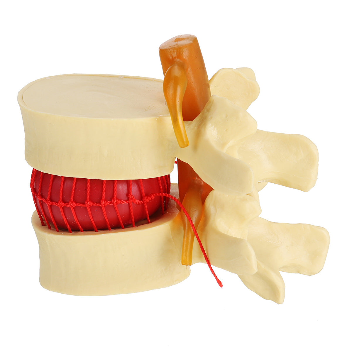 anatomisch menselijk skelet wervelkolom lumbale wervels degeneratieve schijf model